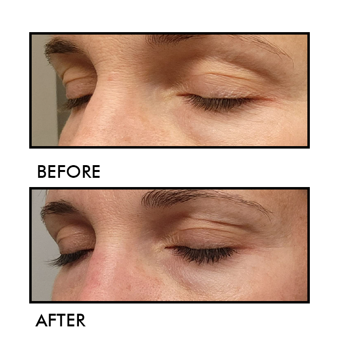 NOIRE Growth Serum