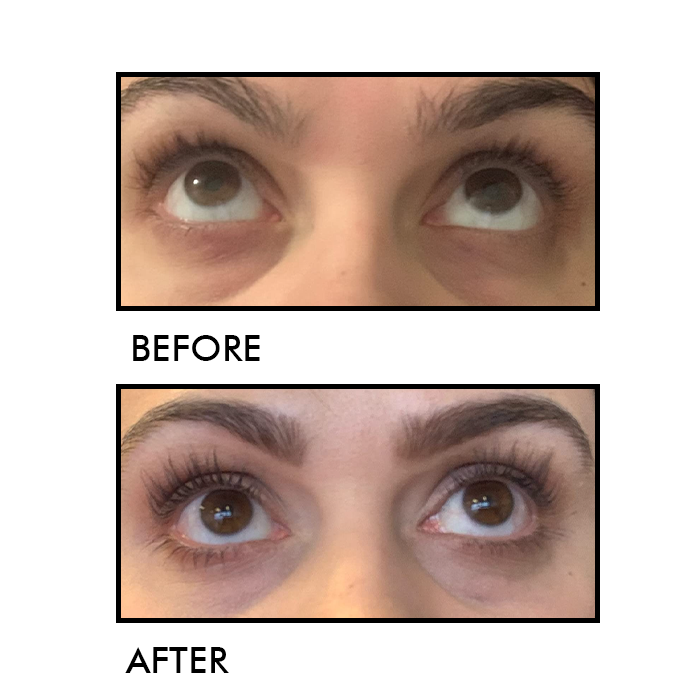 NOIRE Growth Serum