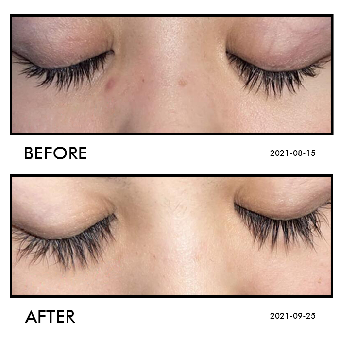 NOIRE Growth Serum